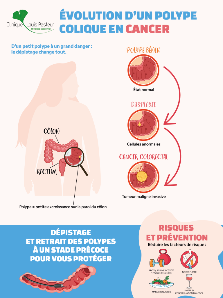 Poster mars bleu endoscopie